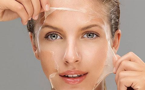 skin chemical peel
