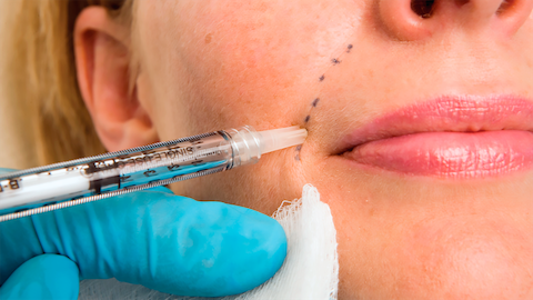 derma fillers